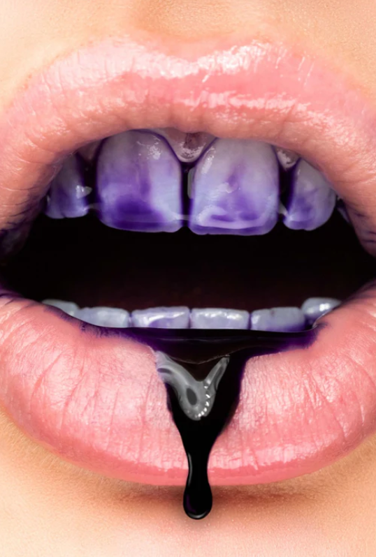 Smileona™ - V34 Purple Teeth Whitening Serum